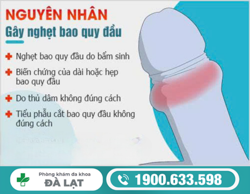 Hình ảnh minh họa